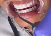 a woman's teeth are being cleaned by a dental hygienist